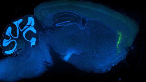  Remipedes! The Astonishing Deep-Sea Crustaceans with Bioluminescent Charms